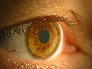 Foto eines Auges mit Kontaktlinse, Praxis Nürnberg